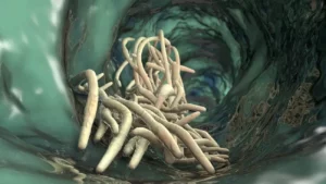 Črevné parazity v ľudskom tráviacom trakte – ilustrácia napadnutého čreva parazitickými červami.