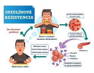 Inzulínová rezistencia je ochorenie modernej doby