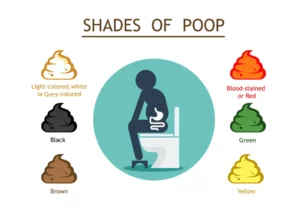 Zelená stolica v toaletnej mise, ilustrácia odlišnej farby stolice ako príznaku vplyvu stravy, liekov alebo tráviacich ochorení.