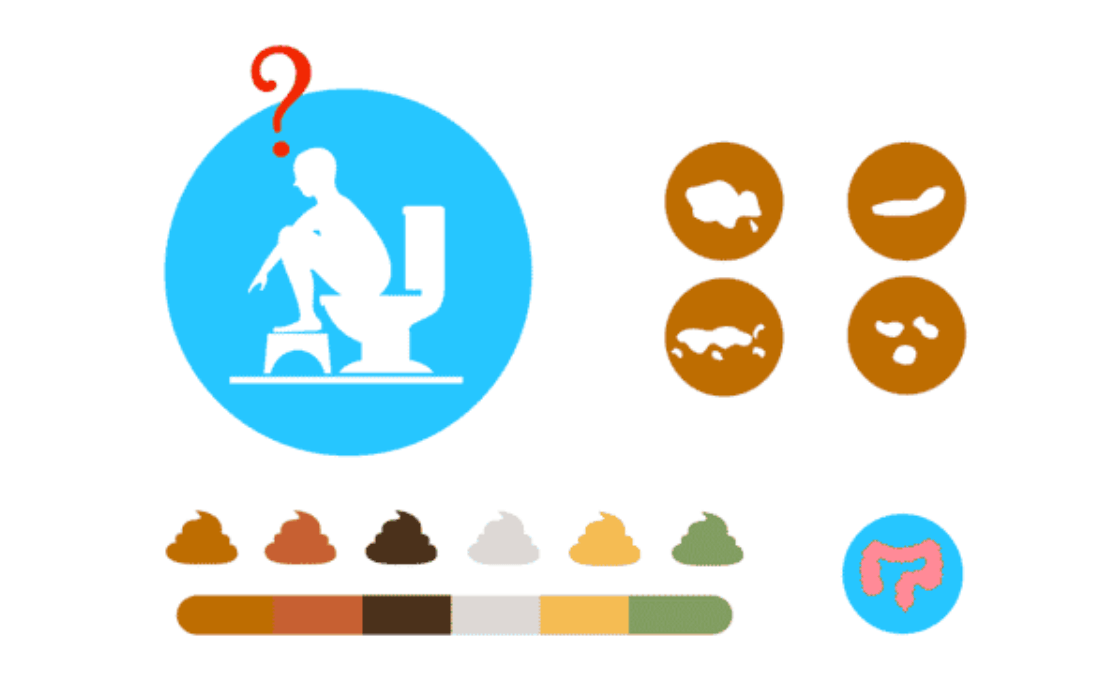 Rôzne typy stolice v toaletnej mise, znázornenie farebných a tvarových odchýlok ako indikátorov zdravia tráviaceho systému.