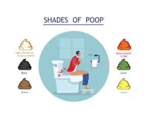 Žltá stolica v toaletnej mise, znázornenie zmeny farby stolice ako príznaku tráviacich alebo zdravotných problémov.