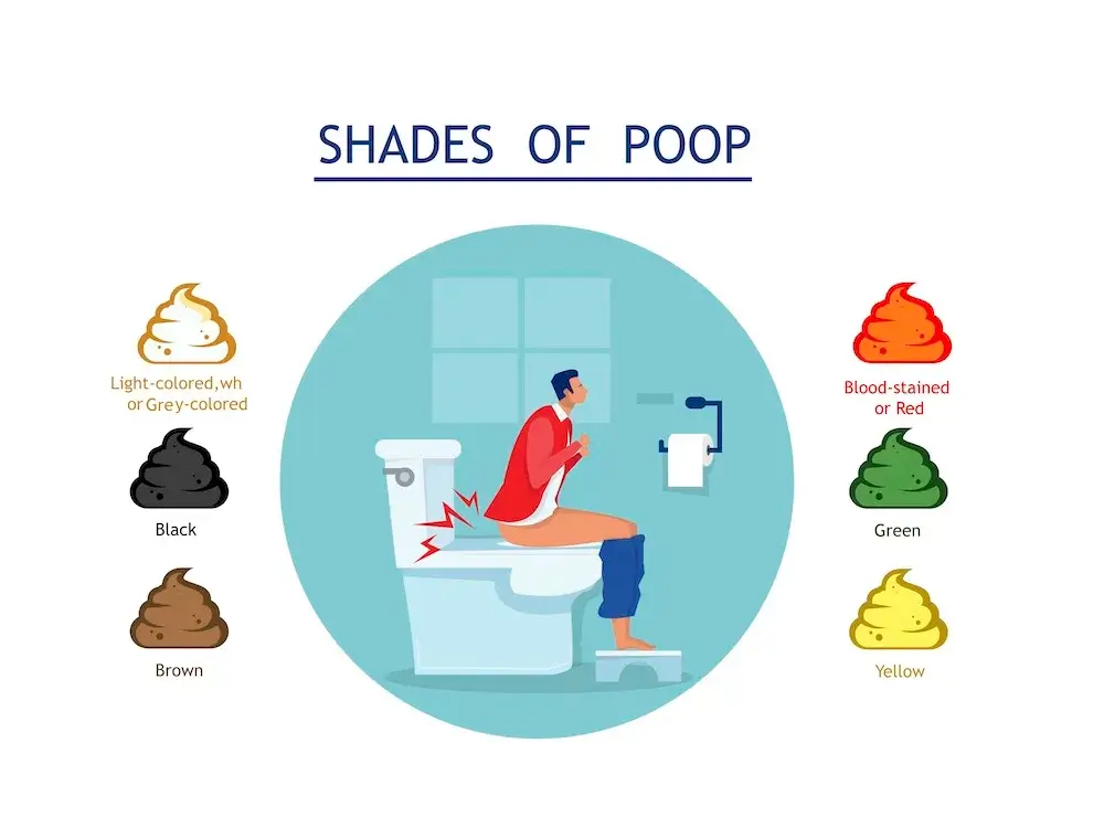 Žltá stolica v toaletnej mise, znázornenie zmeny farby stolice ako príznaku tráviacich alebo zdravotných problémov.