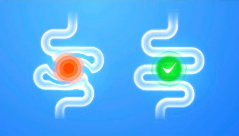 Schéma ľudského črevného traktu s vyznačením problematického miesta (červený kruh) versus zdravého čreva (zelená fajka) – vizuálne znázornenie rozdielu medzi poruchou a zdravím čriev.