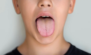 Jazyk s rôznou farbou a povlakom zobrazujúci zdravotné stavy tela, napríklad červený, biely, žltý, fialový alebo hnedý jazyk.