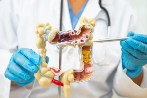 Lekár ukazujúci model čreva s vyznačenými vrstvami črevnej steny, poukazujúc na ich význam v trávení, imunite a ochrane pred ochoreniami.