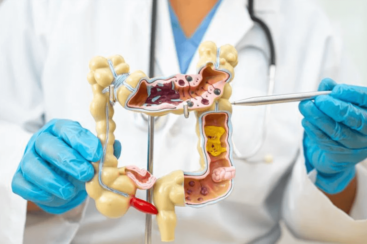 Lekár ukazujúci model čreva s vyznačenými vrstvami črevnej steny, poukazujúc na ich význam v trávení, imunite a ochrane pred ochoreniami.